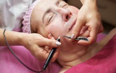 הסרת שיער בפנים בכרמיאל